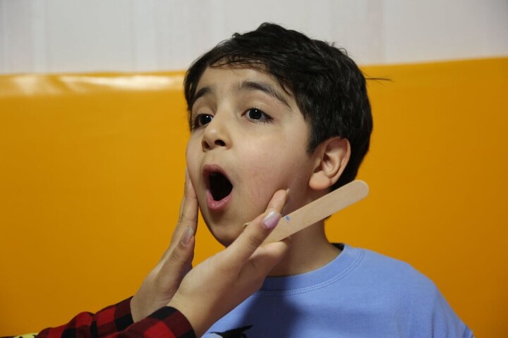 لکنت زبان