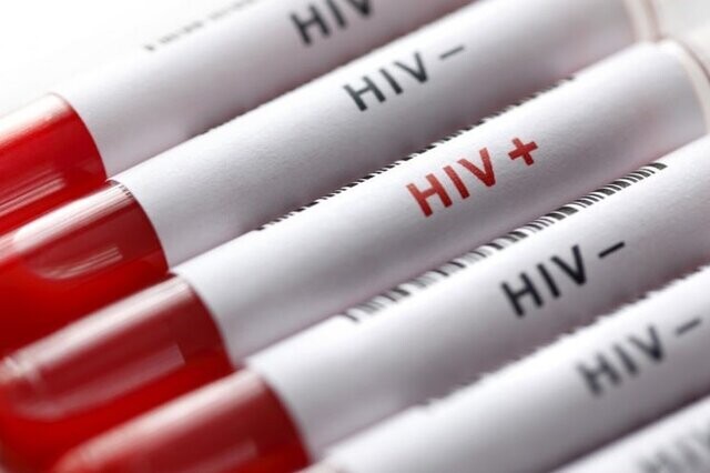 HIV