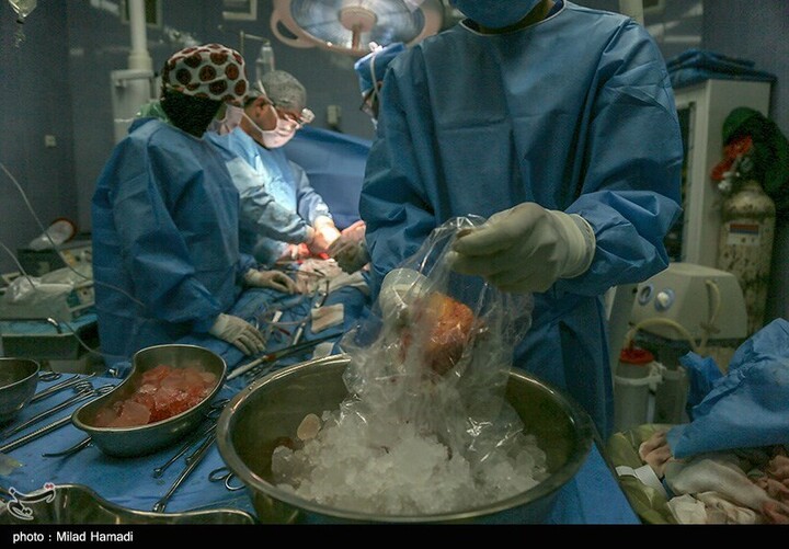 اهدای عضو