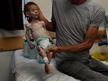 شهادت دختر بچه ۴ ساله فلسطینی بر اثر گرسنگی
