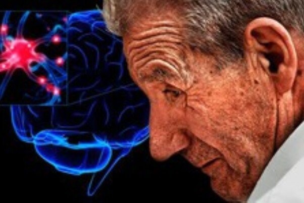 ارتباط سندرم متابولیک با بیماری پارکینسون پارکینسون