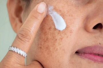 آلودگی هوا و پوست؛ چگونه از التهاب و خطر سرطان پیشگیری کنیم؟