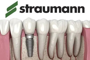 هر آنچه در مورد ایمپلنت سوئیسی اشترومن لازم است بدانید!