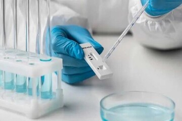 کیت‌های پزشکی با پیل سوختی طراحی شد؛ ارسال نتیجه به موبایل پزشک