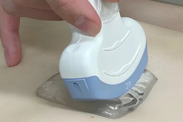 سونوگرافی با یک پد ژل نوآورانه، تجربه‌ای خوشایند